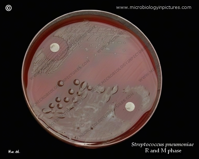 positive optochin test result